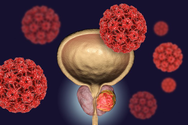 17 Warning Signs Of Prostate Cancer