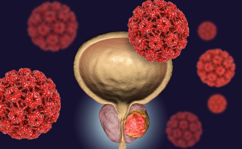 17 Warning Signs Of Prostate Cancer
