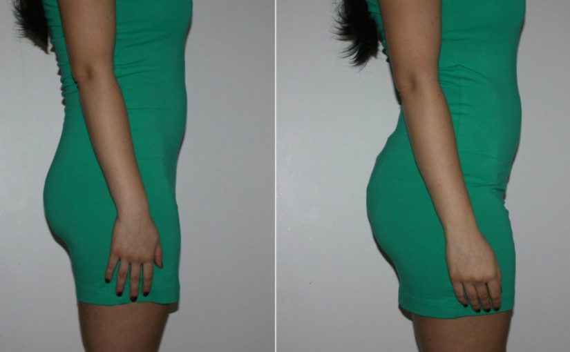 The Scary Truth About Brazilian Butt Lifts