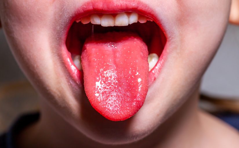 What Is Strawberry Tongue And How To Avoid Catching It