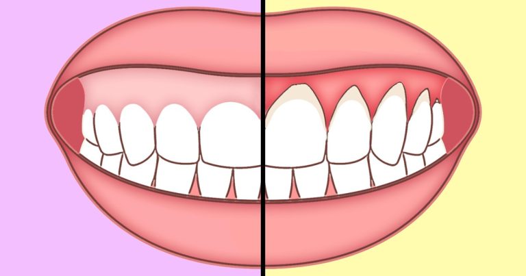 Easy Habits To Improve Your Tooth Health
