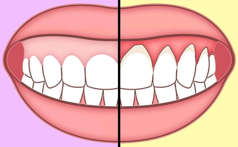 Easy Habits To Improve Your Tooth Health