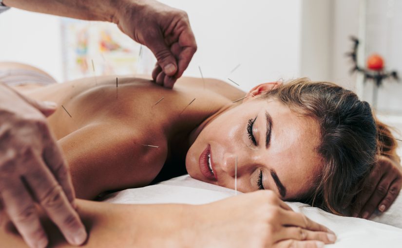 Will Acupuncture Work Wonders For Your Anxiety?