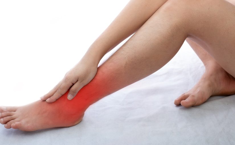 Surprisingly Easy Ways To Get Rid of Varicose Veins
