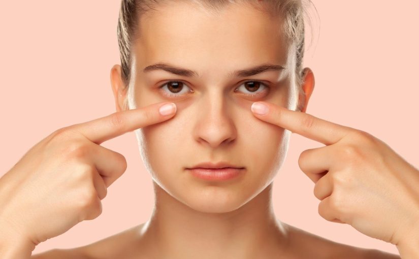 Dark Circles Under the Eye May Be a Major Health Warning